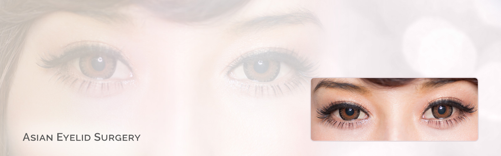 Asian Eyelid Surgery