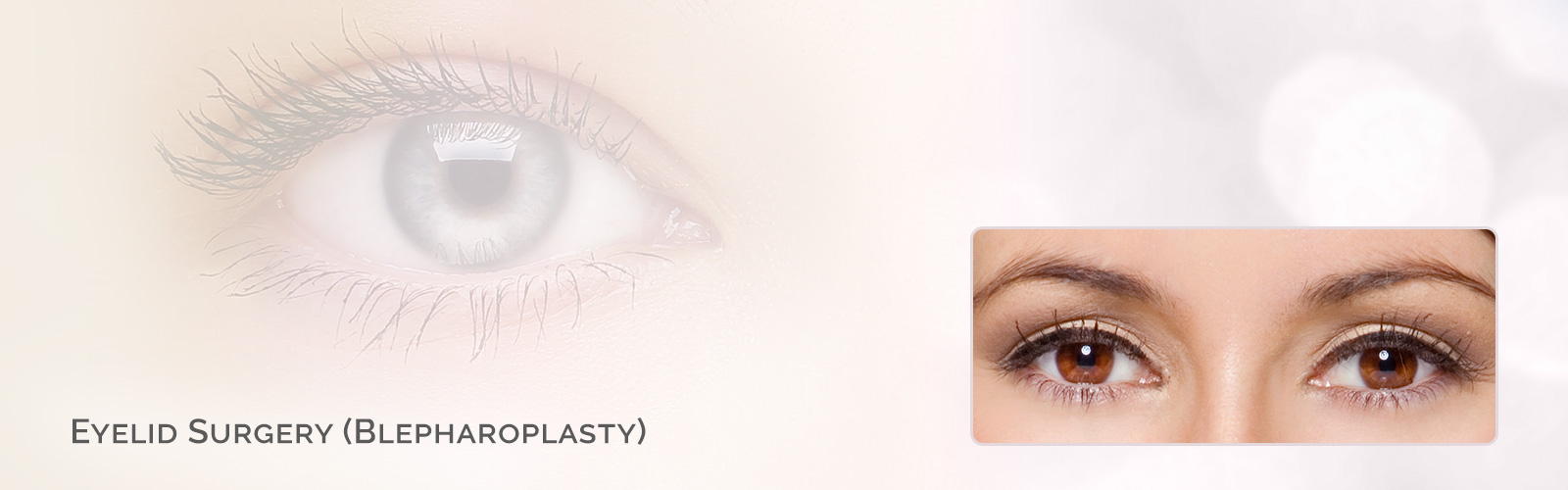 Eyelid Surgery